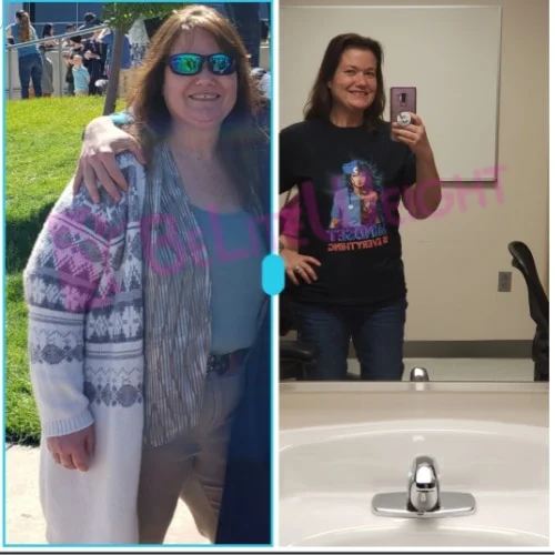 Teressa H - 11 Month Update*